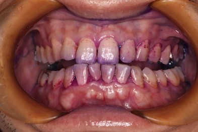 染め出しの写真