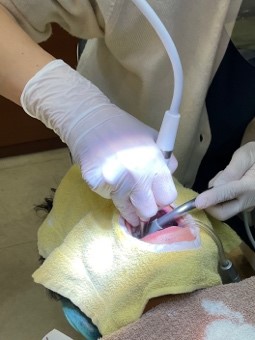 エアフローを用いたクリーニング